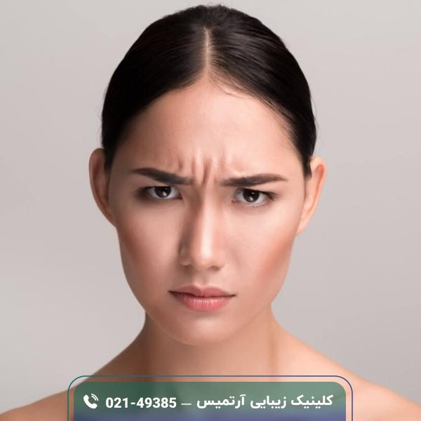 فیلر خط اخم چیست؛ نحوه تزریق، مراقبت ها و هزینه