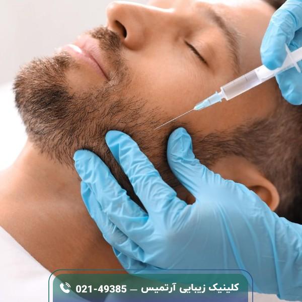 مزو تراپی ریش و سبیل؛ کاربرد، عوارض، هزینه