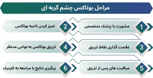 اینفوگرافی مراحل بوتاکس چشم گربه ای