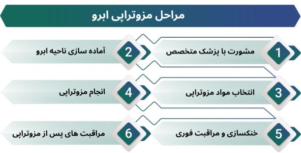 اینفوگرافی مراحل مزوتراپی ابرو