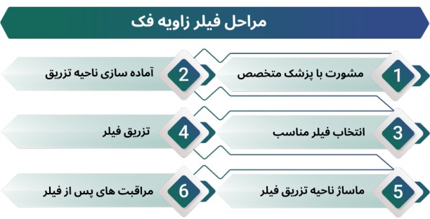 اینفوگرافی مراحل تزریق فیلر زاویه فک