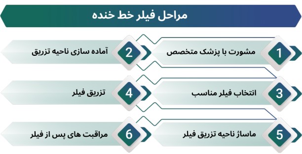 اینفوگرافی مراحل فیلر خط خنده