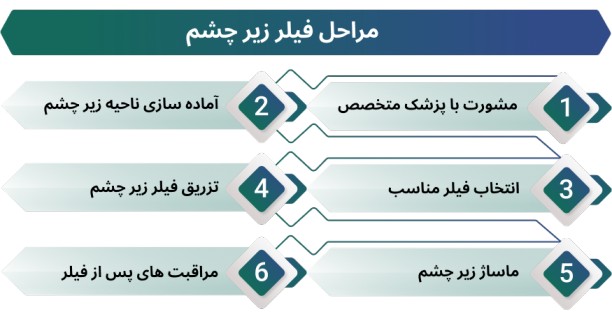 اینفوگرافی مراحل فیلر زیر چشم