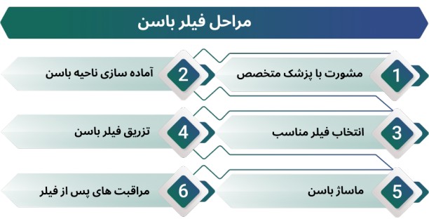 اینفوگرافی مراحل فیلر باسن