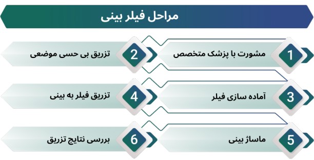 اینفوگرافی مراحل فیلر بینی