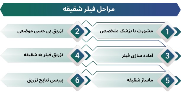 اینفوگرافی مراحل فیلر شقیقه