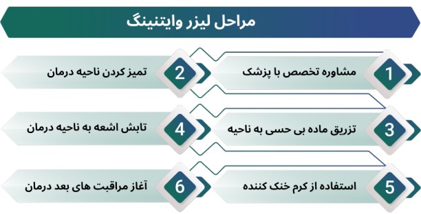 اینفوگرافی لیزر وایتنینگ