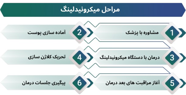 مراحل میکرونیدلینگ