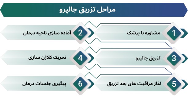 اینفوگرافی تزریق جالپرو