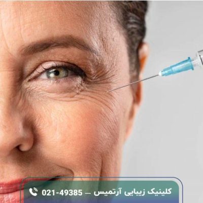 اثر بوتاکس بعد چند روز مشخص میشود؟