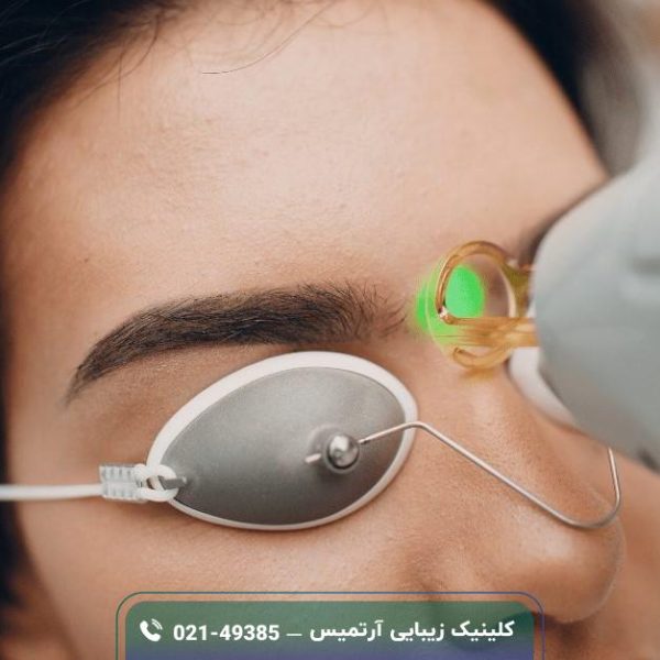 لیزر موهای زائد صورت؛ مراحل، مزایا و معایب، اقدامات لیزر موهای زائد صورت؛ مراحل، مزایا و معایب، اقدامات