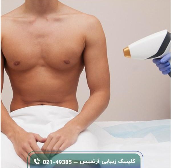 لیزر ناحیه تناسلی مردان؛ نحوه، فواید، قیمت لیزر ناحیه تناسلی مردان؛ نحوه، فواید، قیمت
