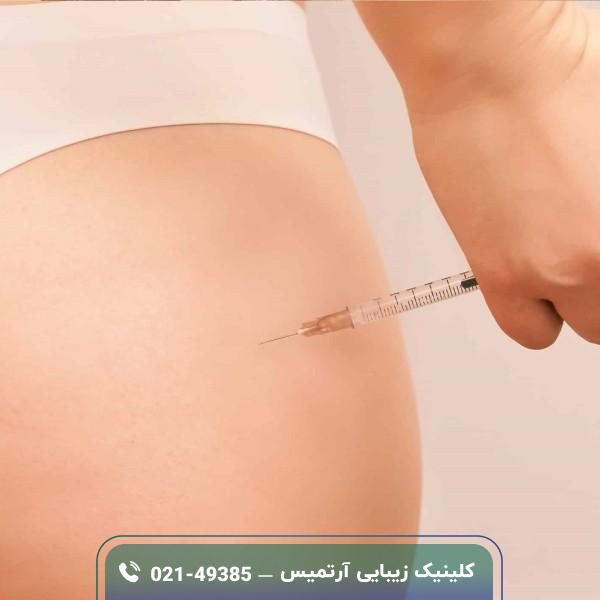 فیلر باسن چیست؛ مزایا، مراقبت ها و قیمت فیلر باسن چیست؛ مزایا، مراقبت ها و قیمت