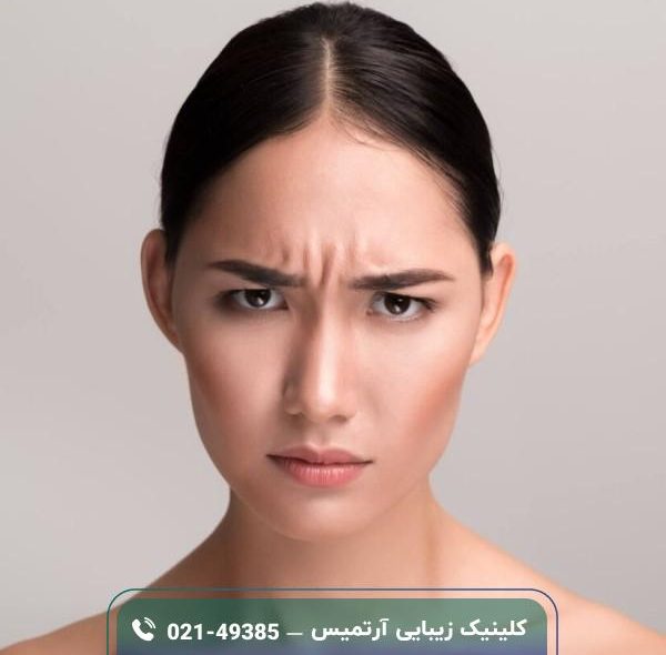 فیلر خط اخم چیست؛ نحوه تزریق، مراقبت ها و هزینه