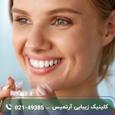 تغییر فرم لب بعد از ارتودنسی؛ خوب یا بد؟