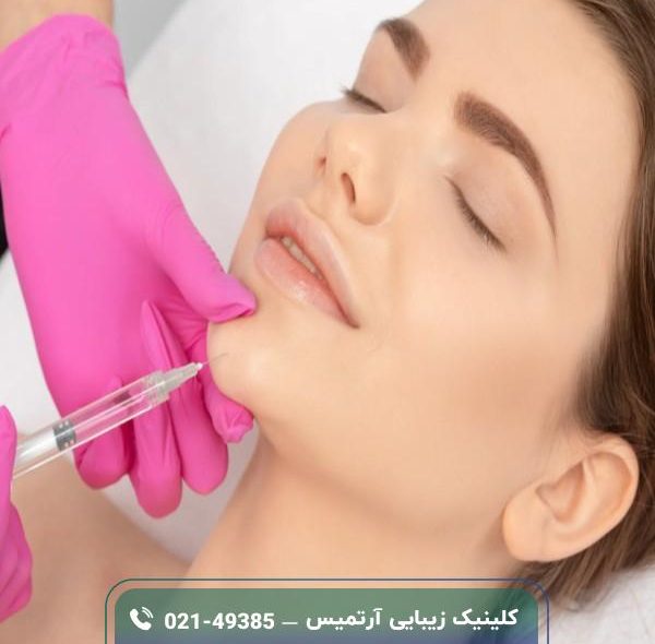 فیلر زاویه فک چیست؛ کاربرد، مزایا، عوارض و هزینه